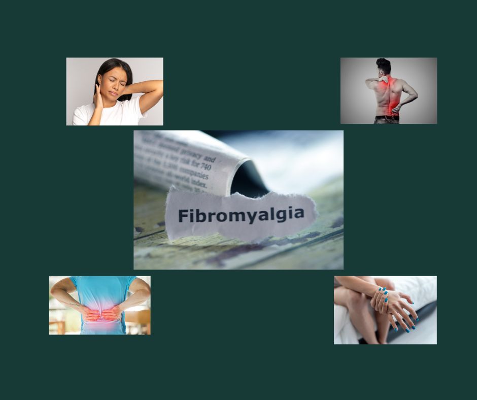 Treating Fibromyalgia with Orthomolecular Medicine: The Role of Vitamin D, Thiamine, and Other Co-factors